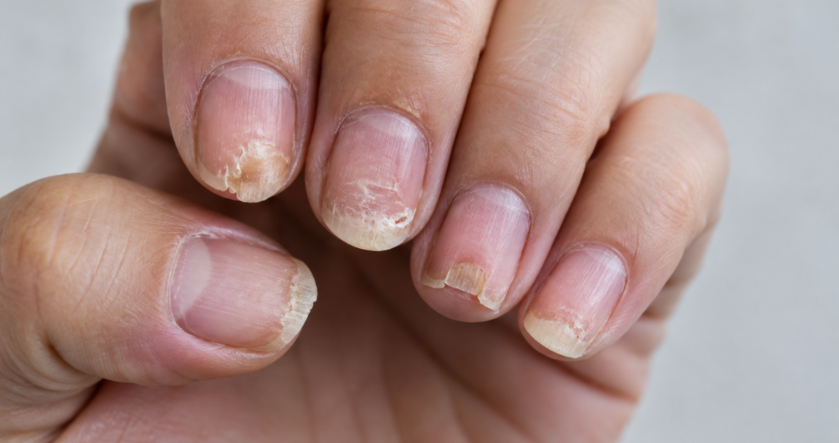 Uñas