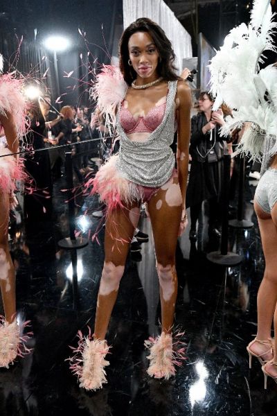 Winnie Harlow rompió estereotipos en desfile de Victoria's Secret: es el  primer 